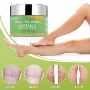 Vein Repair Cream